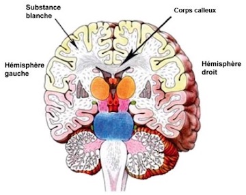 Schéma du cerveau avec hémisphères gauche et droit, substance blanche, corps calleux